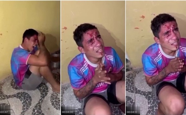 王老师缅北视频真实缅北刀割鸟啄捶打下体活埋等合集-大漠瓜客-免费吃瓜